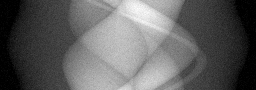 Measurement I