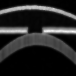 Reconstruction II